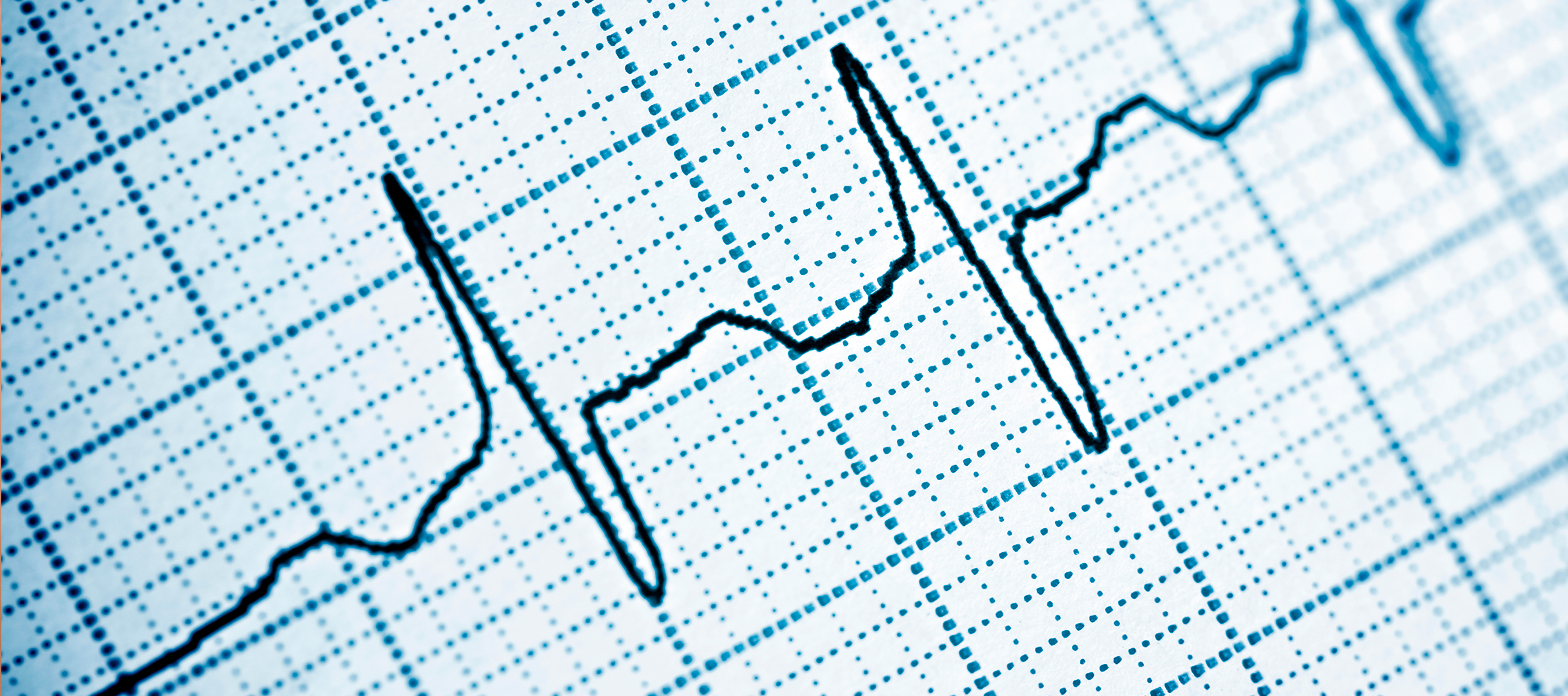 krzywa EKG