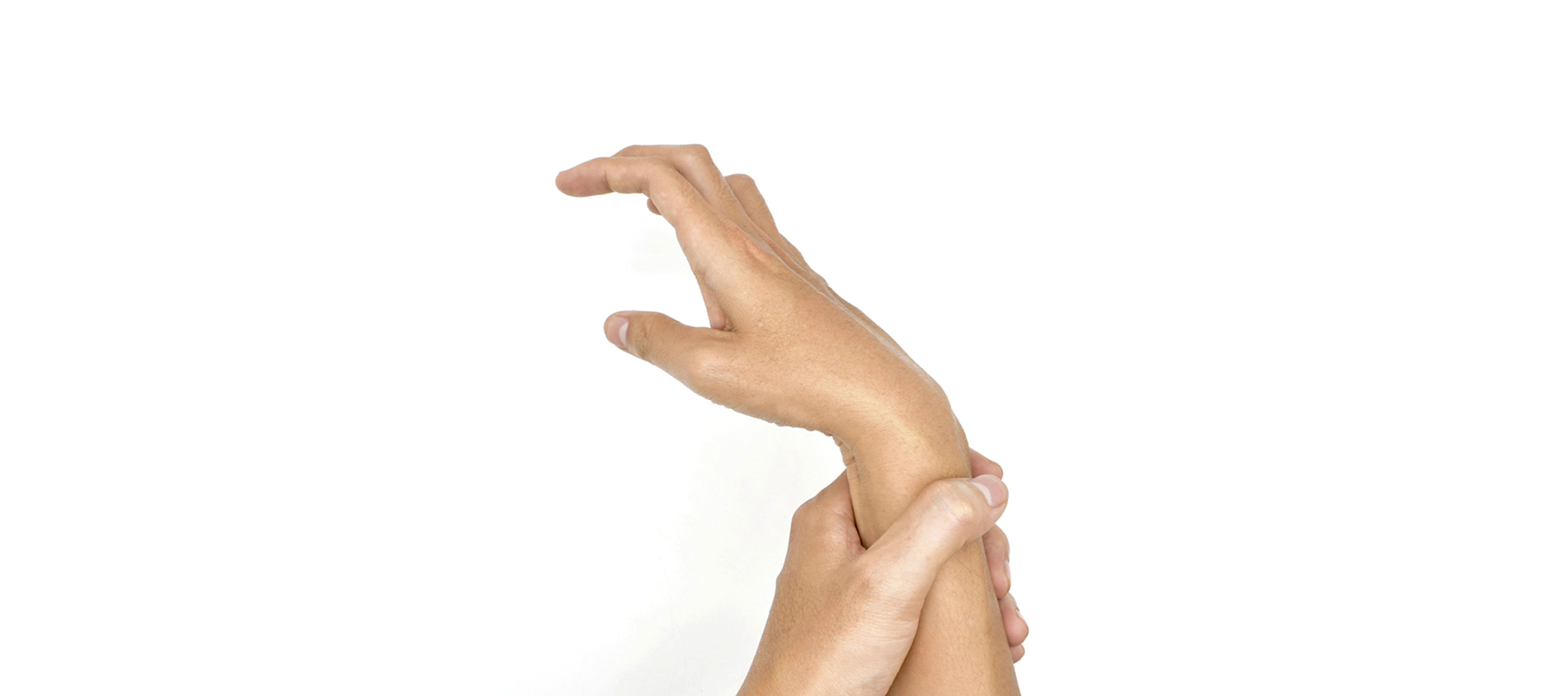 Widok dłoni chorego na MPD w nienaturalnym wygięciu